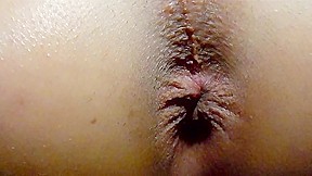Pictures Of Buttholes